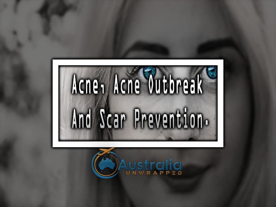 Acne, Acne Outbreak And Scar Prevention.