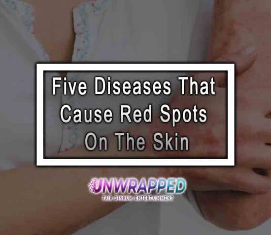Five Diseases That Cause Red Spots On The Skin
