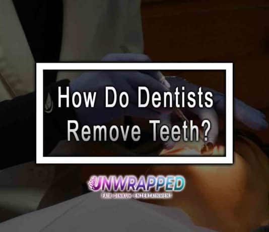 How Do Dentists Remove Teeth?