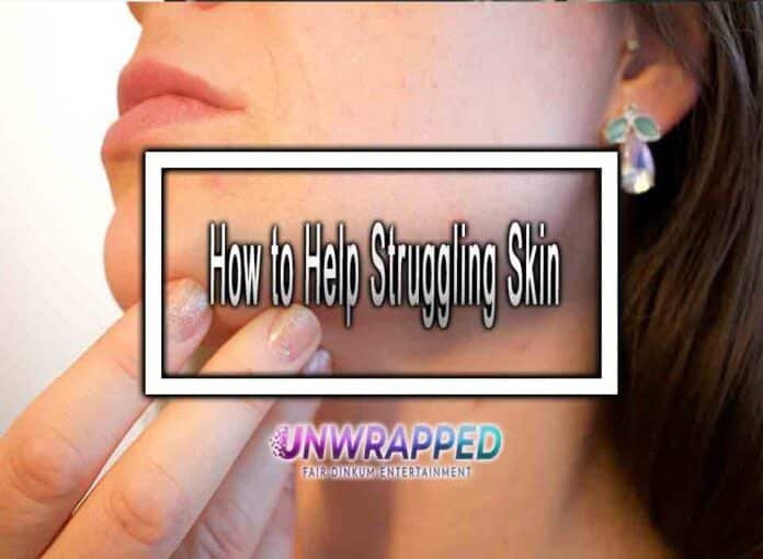 How to Help Struggling Skin