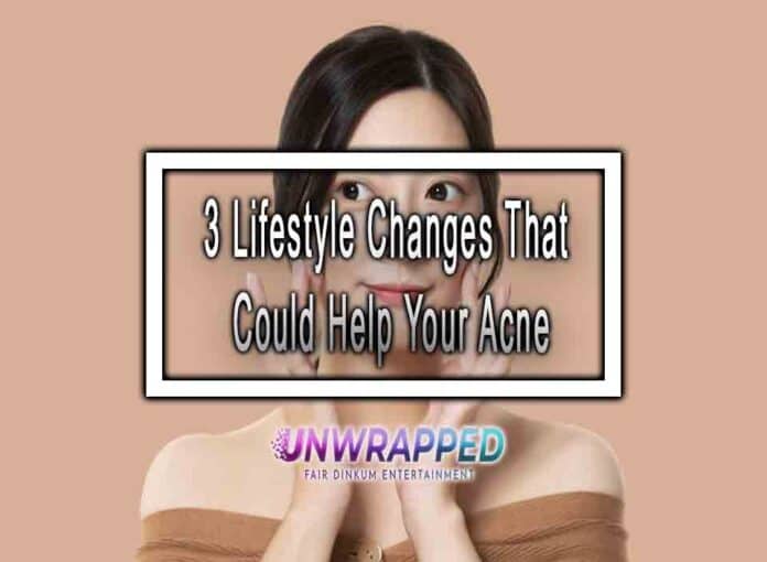 3 Lifestyle Changes That Could Help Your Acne