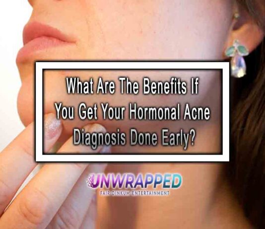 What Are The Benefits If You Get Your Hormonal Acne Diagnosis Done Early?