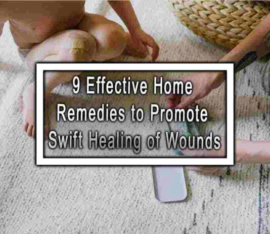 9 Effective Home Remedies to Promote Swift Healing of Wounds