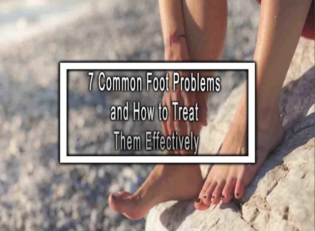 7 Common Foot Problems And How To Treat Them Effectively