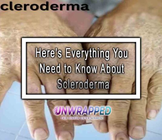 Here's Everything You Need to Know About Scleroderma