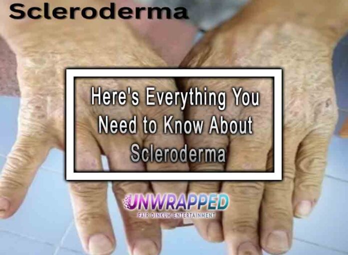 Here's Everything You Need to Know About Scleroderma