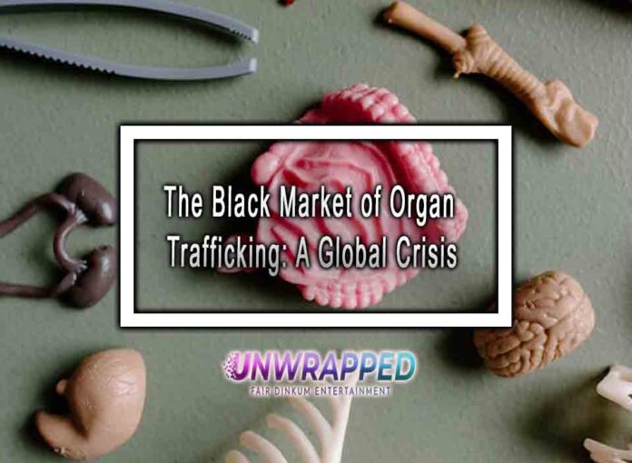 The Black Market of Organ Trafficking A Global Crisis The Black Market of Organ Trafficking: A Global Crisis