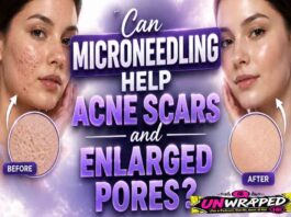 Can Microneedling Help Acne Scars and Enlarged Pores?