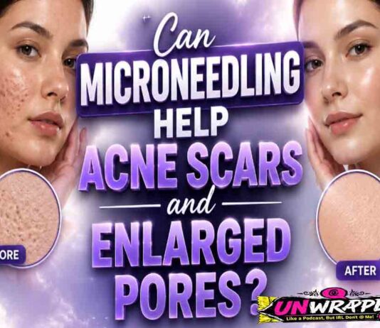 Can Microneedling Help Acne Scars and Enlarged Pores?